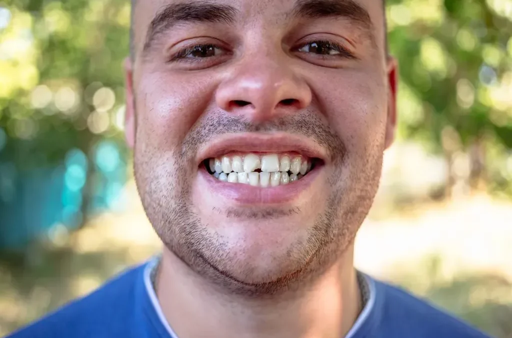 3 Habits That Can Chip and Damage Your Teeth
