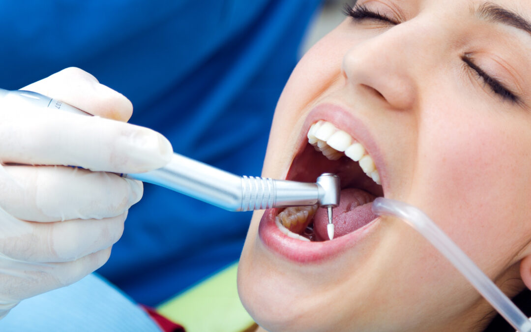 10 Signs You Need a Tooth Extraction