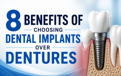 8 Benefits of Choosing Dental Implants Over Dentures